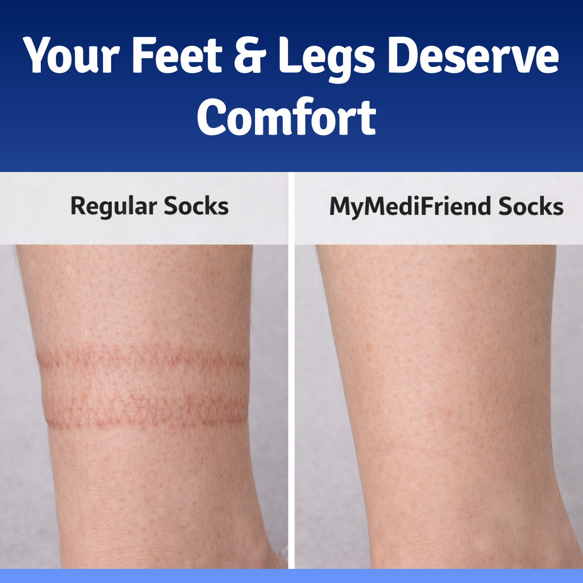 Socks for People with Diabetes
